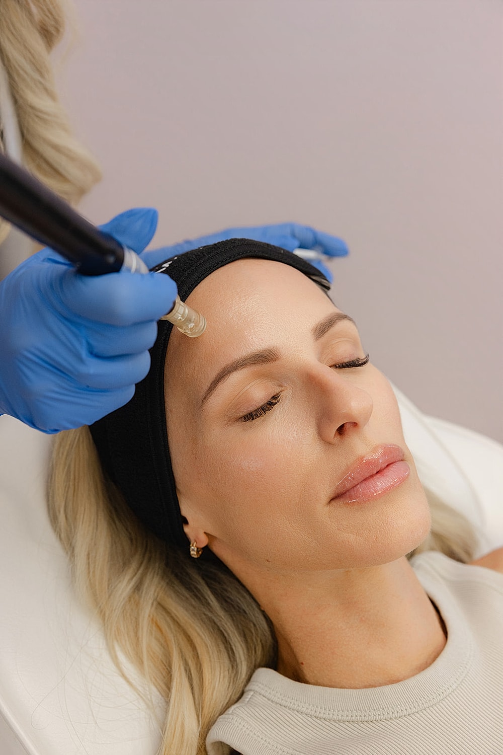 Woman receiving a cosmetic treatment on her forehead.